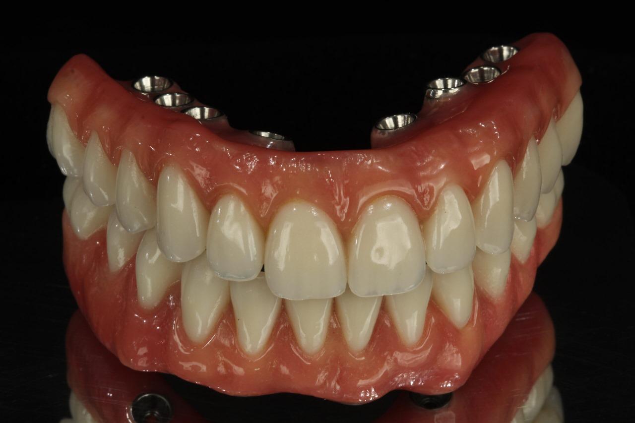 Reabilitação Protética